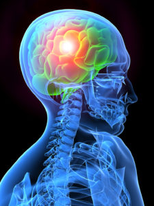 upper-cervical-chiropractic-approach-treating-concussions-calgary-ab